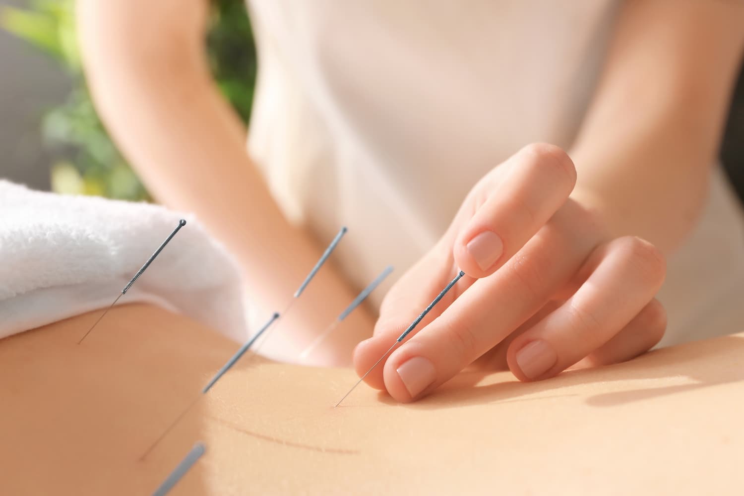 acupuncture Koh Lanta